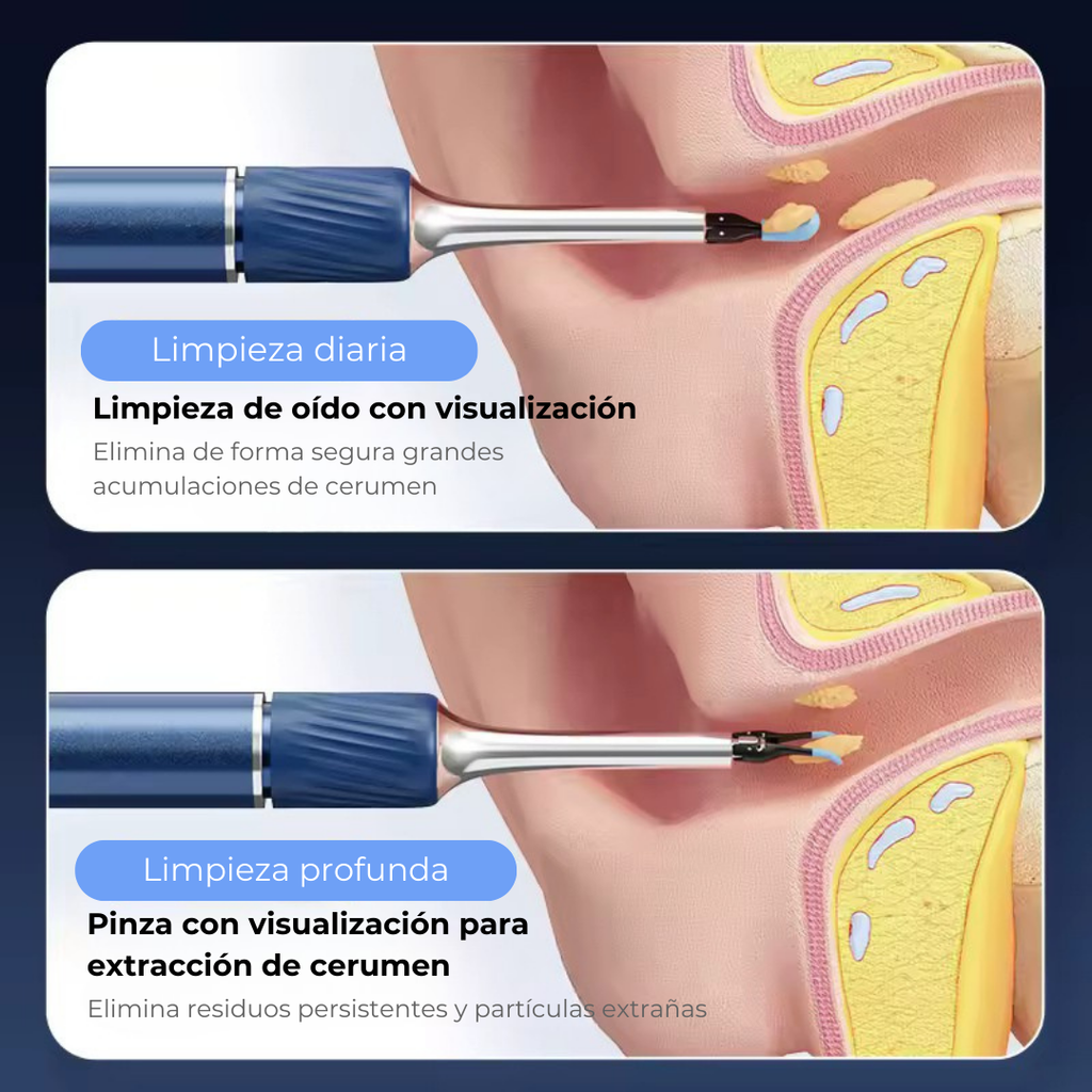 Limpiador Inteligente de Oído Inalámbrico con Cámara 4K (Android / iOS)