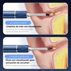 Limpiador Inteligente de Oído Inalámbrico con Cámara 4K (Android / iOS)